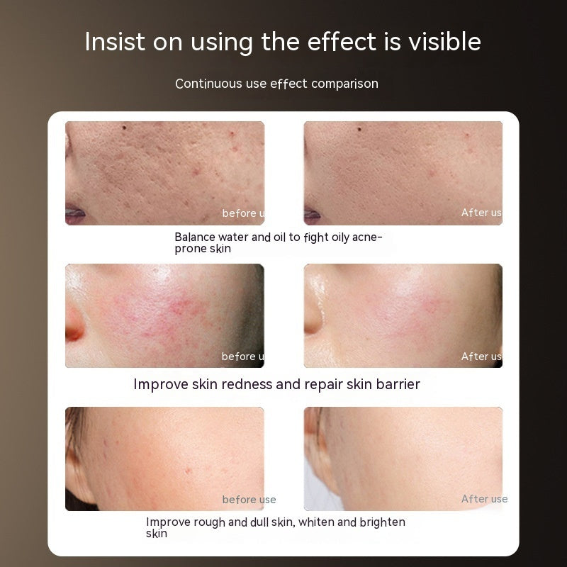 Melysiabeauty 赤外線若返り美容マスク | アンチエイジング、深層浸透、肌再生セラピー