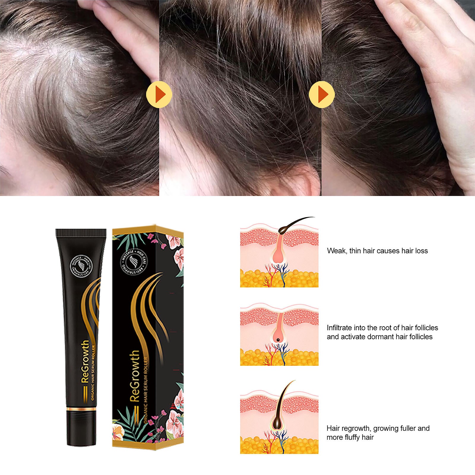 Hair Density Serum for Thinning Hair, hair density serum, thinning hair serum, scalp density serum, hair thickening serum, hair growth support serum, volumizing hair serum, scalp care serum, hair strengthening serum, fuller hair treatment