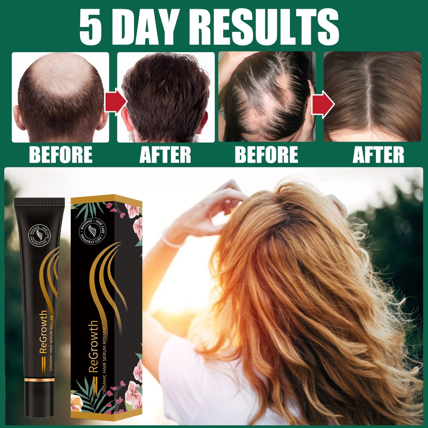 Hair Density Serum for Thinning Hair, hair density serum, thinning hair serum, scalp density serum, hair thickening serum, hair growth support serum, volumizing hair serum, scalp care serum, hair strengthening serum, fuller hair treatment
